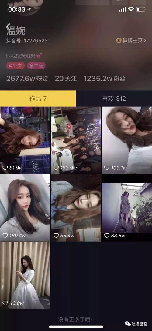 抖音网红免费吃瓜,揭秘网红圈幕后福利